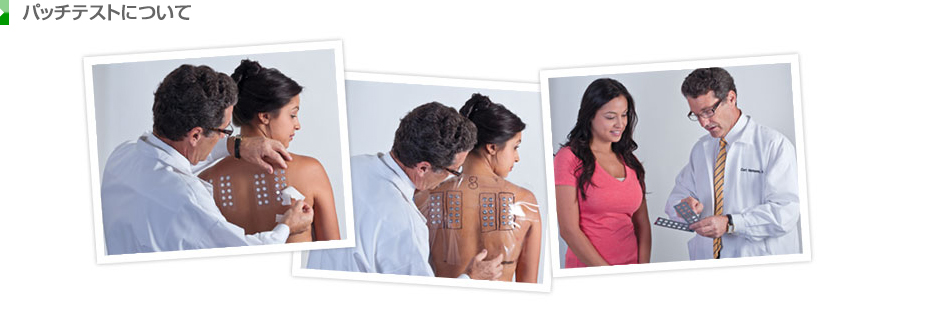 パッチテストについて